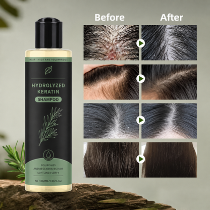 Organic Rosemary Hair Growth Shampoo