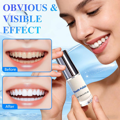 Tooth Polisher — Instantly Whiter Smile🦷